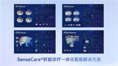 商湯醫(yī)療獲肝臟CT輔助診斷NMPA三類(lèi)證，軟硬件零售賦能肝臟診療一體化新格局